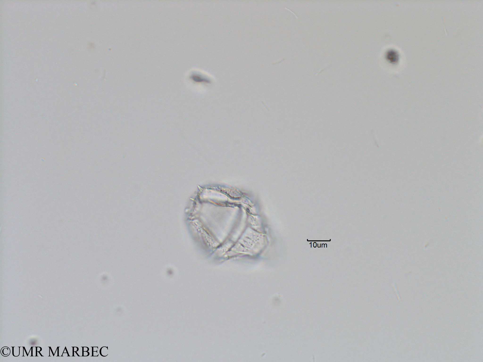 phyto/Bizerte/bizerte_bay/RISCO November 2015/Gonyaulax sp11 (Baie_T5-C2-Gonyaulax cf spinifera-2).tif(copy).jpg